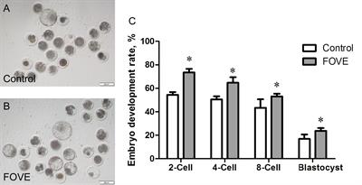 Dietary flaxseed oil and vitamin E improve semen quality via propionic acid metabolism